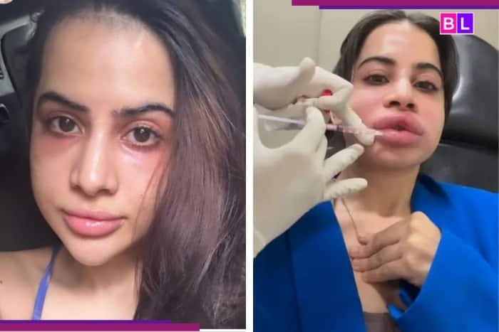¿Los métodos cosméticos de Uorphi Javed desencadenaron el cuerpo dismorfia? Dentro de su lucha con la salud mental …: ‘Dejé de comer …’