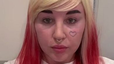 Amanda Baines compartió una nueva apariencia con los fanáticos después del método de relleno de labios