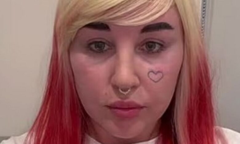 Amanda Baines compartió una nueva apariencia con los fanáticos después del método de relleno de labios Amanda Baines compartió una nueva apariencia con los fanáticos después del método de relleno de labios