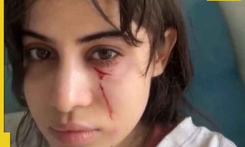 Forfi Javed ha atacado brutalmente por sí mismo … Forfi Javed ha atacado brutalmente por sí mismo …