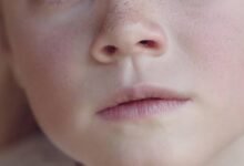 ¿Por qué mi nariz gotee líquido amarillo? Las respuestas que estás buscando