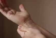 Comprender la pérdida de cabello y la importancia de los controles de cáncer de piel en Sydney