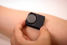 El sensor de sudor de cloruro revoluciona el diagnóstico de fibrosis quística