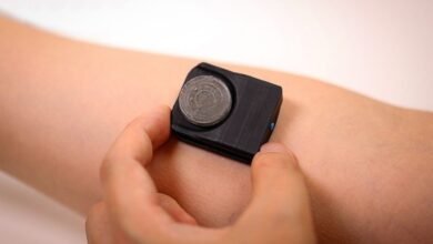El sensor de sudor de cloruro revoluciona el diagnóstico de fibrosis quística