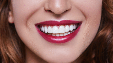 El mejor lugar para carillas en la República Dominicana en el CED Dental Center