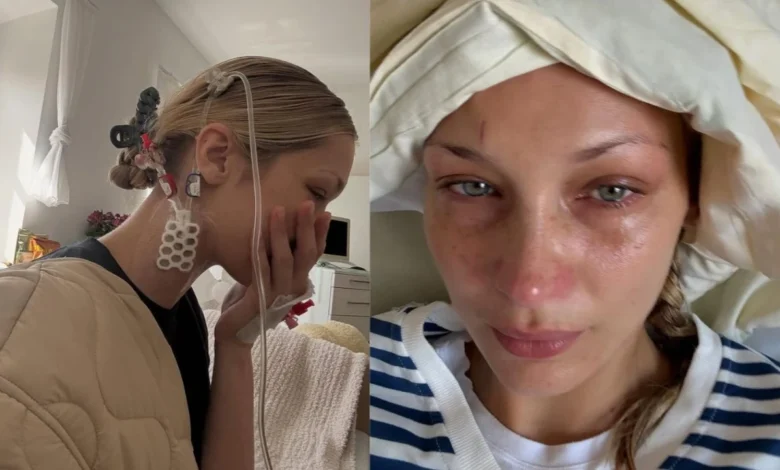 Bella Hadid compartió fotos del hospital en la batalla en curso con la enfermedad de lima, llame a una nota