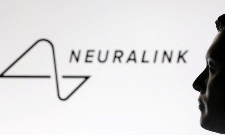 Neuralink de Elon Musk dice que 12 personas han recibido sus implantes Neuralink de Elon Musk dice que 12 personas han recibido sus implantes