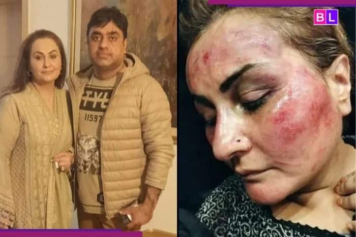 Esta actriz paquistaní fue brutalmente golpeada y amenazada … fue víctima del horror, la brutalidad …