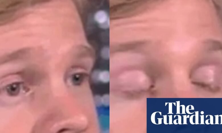 El hombre que se hizo popular en parpadear White Guy GIF recauda más de $ 300,000 para la investigación de esclerosis múltiple | Noticias de EE. UU.