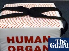 Nueva herramienta de IA podría reducir en un 60% los esfuerzos desperdiciados para trasplantar órganos | Donación de órganos