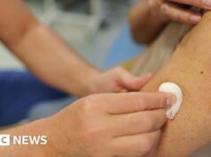 ¿Qué es Mpox y en qué países de la UE están aumentando los casos?