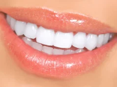 Una sonrisa fresca y segura con carillas dentales en Sydney