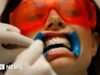 Una investigación de la BBC revela el peligro de la industria del blanqueamiento dental