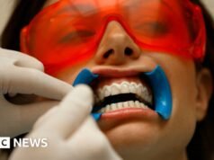Una investigación de la BBC revela el peligro de la industria del blanqueamiento dental