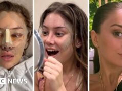 ¿Cirugía plástica a los 28? ¿Por qué los jóvenes recurren a la cirugía plástica?