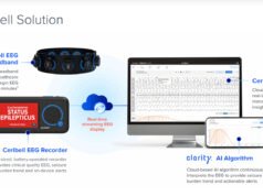 La Administración de Alimentos y Medicamentos de EE. UU. aprobó el dispositivo EEG impulsado por inteligencia artificial de Ceribell como el primer dispositivo de monitoreo continuo del delirio.