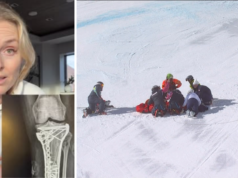 Lindsey Vonn dijo que la cirugía la salvó de que le amputaran la pierna izquierda