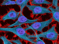 El patrimonio de Henrietta Lacks llega a un acuerdo con Novartis sobre Immortal Cells