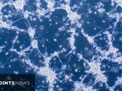 En esta área se analizan las pruebas de tratamiento del cáncer de cerebro que ofrece NeuExcell Therapeutics.