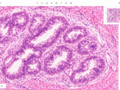 Fluidez de los datos de imágenes: la base de la inteligencia médica multimodal