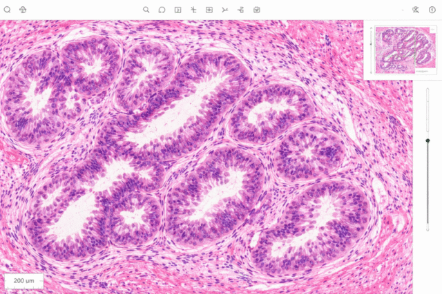 Microscopic-view-of-glandular-tissue-1024x683.png