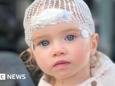 Los padres de un niño gravemente enfermo hablan de “agotamiento” después de que se les negara el cuidado de relevo