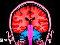 ¿Podría un pulso de electricidad que llegue al cerebro hacernos menos egoístas?