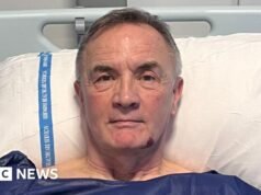 El primer tratamiento innovador del Reino Unido utilizado para enfermedades cardíacas “debilitantes”.