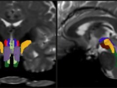 Algoritmo de IA permite el seguimiento de vías vitales de la materia blanca | Noticias del MIT