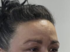 Tomo 120 comprimidos a la semana después de mi operación de malla.