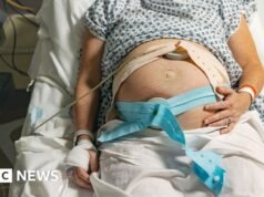 El informe encuentra que el racismo y la dotación de personal son factores que conducen al “fracaso” de la atención de maternidad.