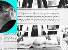 La tecnología está cambiando el tratamiento de la apnea del sueño