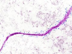 Los investigadores del cáncer identifican un nuevo objetivo potencial para los tumores sólidos