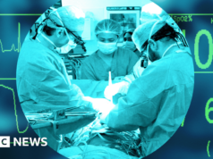 El sistema de trasplantes del Reino Unido alguna vez fue líder mundial, pero ahora está por detrás de otros países occidentales.