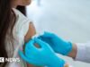 ¿Cuáles son los síntomas de la meningitis? ¿Existe alguna vacuna?