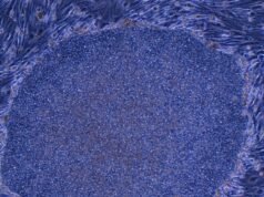 Japón aprueba el primer tratamiento del mundo elaborado con células humanas reprogramadas